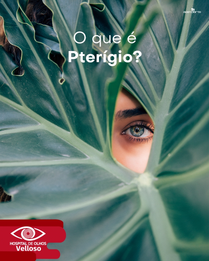 O que é Pterígio?