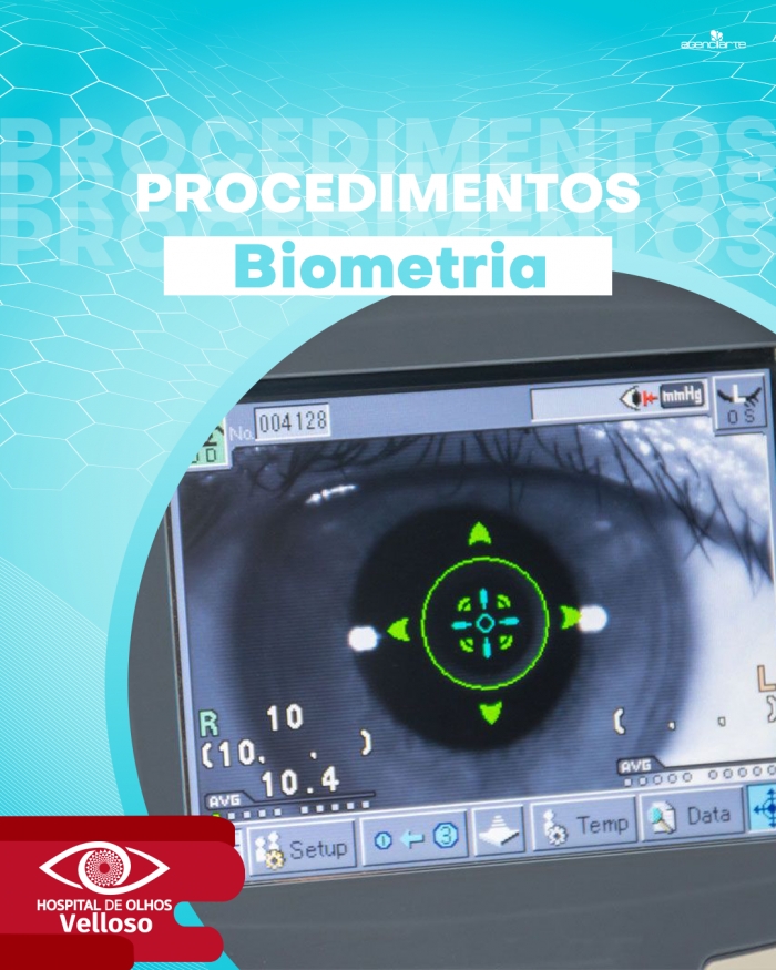 Procedimentos - Biometria