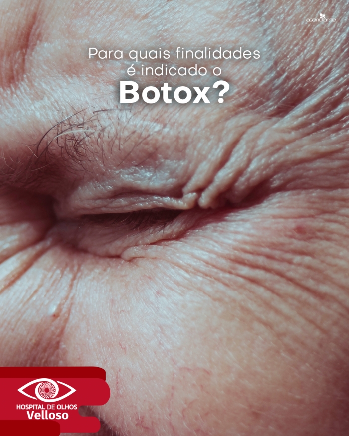 Para quais finalidades é indicado o Botox?