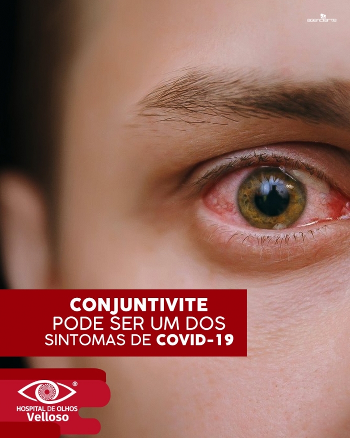 Conjuntivite pode ser um dos sintomas do Covid-19