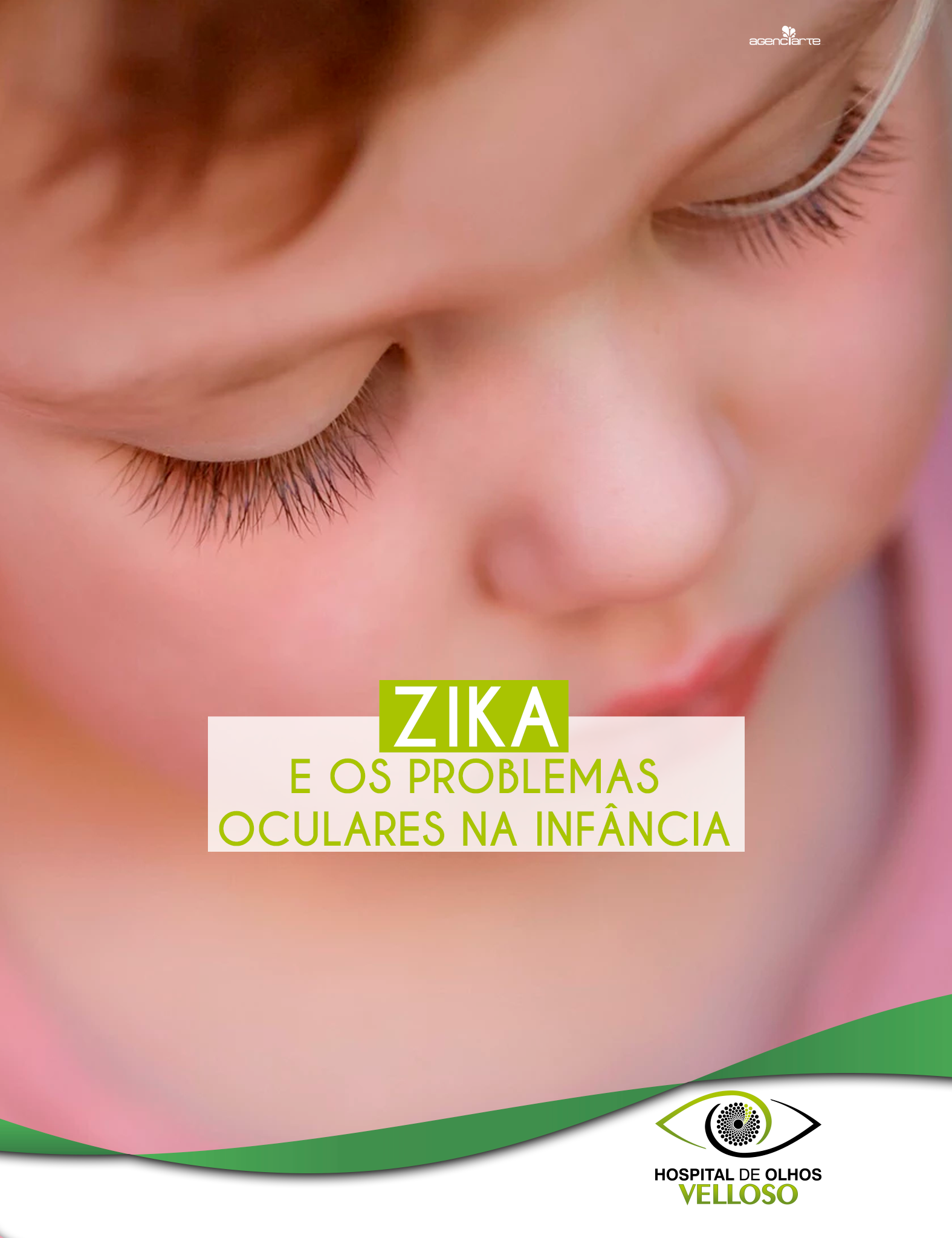 ZIKA E PROBLEMAS OCULARES NA INFÂNCIA